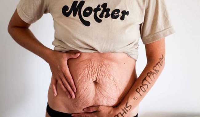 Νέα καμπάνια στο Instagram δείχνει πώς είναι πραγματικά ένα σώμα μετά την εγκυμοσύνη (pics)